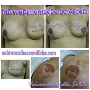 micropigmentação areola